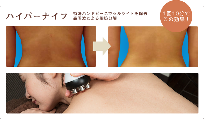 ハイパーナイフ